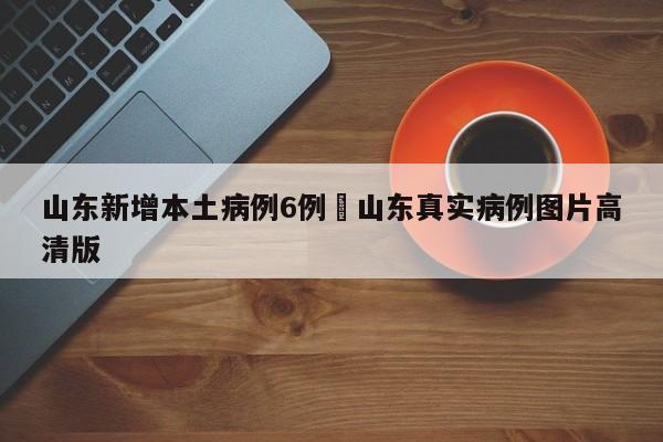 山东新增本土病例6例›山东真实病例图片高清版